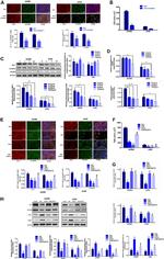 ZO-1 Antibody in Western Blot, Immunocytochemistry (WB, ICC/IF)