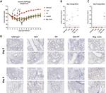 SARS/SARS-CoV-2 Nucleocapsid Antibody in Immunohistochemistry (IHC)