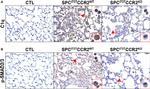 Phospho-SMAD3 (Ser425) Antibody in Immunohistochemistry (IHC)