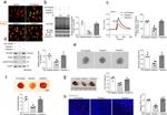 IP3 Receptor 1 Antibody in Western Blot (WB)