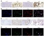 BAG2 Antibody in Immunocytochemistry, Immunohistochemistry (ICC/IF, IHC)