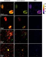 Mouse IgG1 Cross-Adsorbed Secondary Antibody in Immunohistochemistry (IHC)