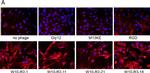 Rabbit IgG (H+L) Highly Cross-Adsorbed Secondary Antibody in Immunocytochemistry (ICC/IF)