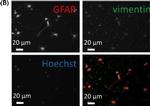 Mouse IgG (H+L) Cross-Adsorbed Secondary Antibody in Immunocytochemistry (ICC/IF)