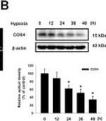 Mouse IgG (H+L) Secondary Antibody in Western Blot (WB)