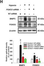 Rabbit IgG (H+L) Secondary Antibody in Western Blot (WB)