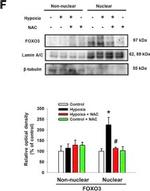 Rabbit IgG (H+L) Secondary Antibody in Western Blot (WB)