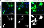 Mouse IgG (H+L) Highly Cross-Adsorbed Secondary Antibody in Immunocytochemistry (ICC/IF)