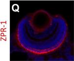 Mouse IgG2a Cross-Adsorbed Secondary Antibody in Immunohistochemistry (IHC)