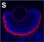 Mouse IgG2a Cross-Adsorbed Secondary Antibody in Immunohistochemistry (IHC)