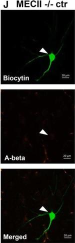 Mouse IgG (H+L) Cross-Adsorbed Secondary Antibody in Immunocytochemistry (ICC/IF)