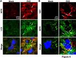 Mouse IgG (H+L) Cross-Adsorbed Secondary Antibody in Immunohistochemistry (IHC)