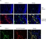 Mouse IgG (H+L) Highly Cross-Adsorbed Secondary Antibody in Immunocytochemistry (ICC/IF)