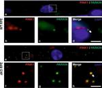 Mouse IgG (H+L) Highly Cross-Adsorbed Secondary Antibody in Immunohistochemistry (Paraffin) (IHC (P))