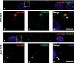 Mouse IgG (H+L) Highly Cross-Adsorbed Secondary Antibody in Immunohistochemistry (Paraffin) (IHC (P))