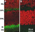 Rabbit IgG (H+L) Highly Cross-Adsorbed Secondary Antibody in Immunohistochemistry (IHC)