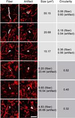 Rabbit IgG (H+L) Highly Cross-Adsorbed Secondary Antibody in Immunohistochemistry (IHC)