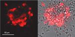 Mouse IgG (H+L) Highly Cross-Adsorbed Secondary Antibody in Immunocytochemistry (ICC/IF)