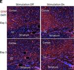 Mouse IgG (H+L) Highly Cross-Adsorbed Secondary Antibody in Immunohistochemistry (IHC)