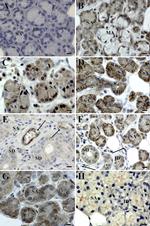 Claudin 2 Antibody in Immunohistochemistry (IHC)