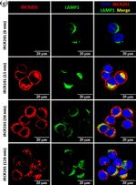 Human IgG (H+L) Cross-Adsorbed Secondary Antibody in Immunocytochemistry (ICC/IF)