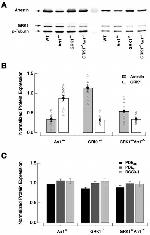 GRK1 Antibody