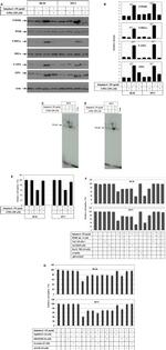 Phospho-IRE1 alpha (Ser724) Antibody in Western Blot (WB)