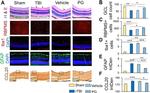 MIP-3 alpha Antibody