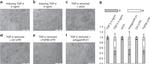 E-cadherin Antibody