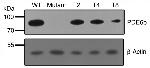 PDE6B Antibody