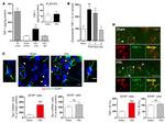 Thrombospondin 1 Antibody