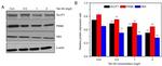 HK2 Antibody