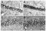 Glucocorticoid Receptor Antibody in Immunocytochemistry, Immunohistochemistry (ICC/IF, IHC)