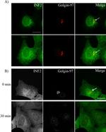 Golgin-97 Antibody