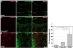 NEFM Antibody