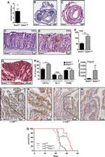 CD3 Antibody in Immunohistochemistry (IHC)