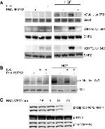 c-Met Antibody in Western Blot (WB)