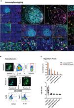 CD20 Antibody in Immunohistochemistry (IHC)