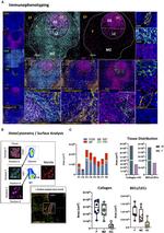 CD20 Antibody in Immunohistochemistry (IHC)