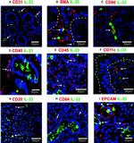 CD20 Antibody in Immunohistochemistry (IHC)