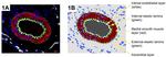 CD31 (PECAM-1) Antibody in Immunohistochemistry (IHC)