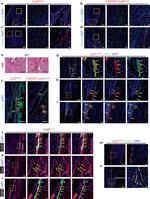 LYVE1 Antibody in Immunohistochemistry (PFA fixed) (IHC (PFA))