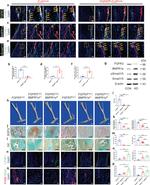 LYVE1 Antibody in Immunohistochemistry (PFA fixed) (IHC (PFA))