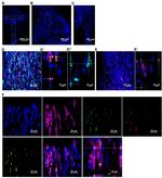 LYVE1 Antibody in Immunohistochemistry (PFA fixed) (IHC (PFA))