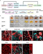 LYVE1 Antibody in Immunocytochemistry (ICC/IF)