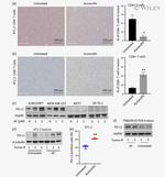 CD8a Antibody in Immunohistochemistry (IHC)