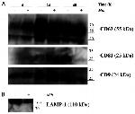 CD107a (LAMP-1) Antibody in Western Blot (WB)