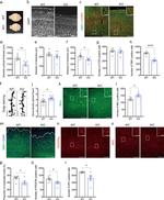 CD140a (PDGFRA) Antibody in Immunohistochemistry (IHC)