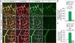 CD140b (PDGFRB) Antibody in Immunohistochemistry (IHC)