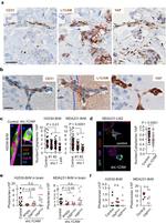 CD171 Antibody in Immunohistochemistry (IHC)